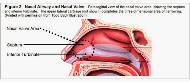 nasal_airway_and_nasal_valve